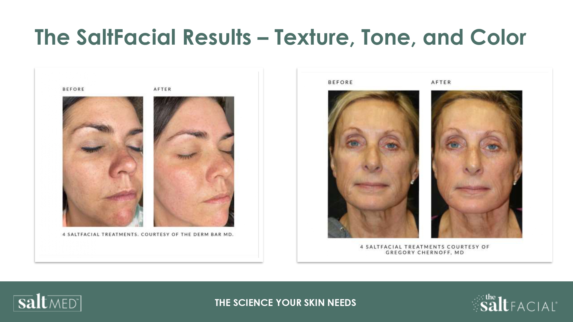 Salt Facial Skin Care Clinic In Ca Abby Skincare Clinic